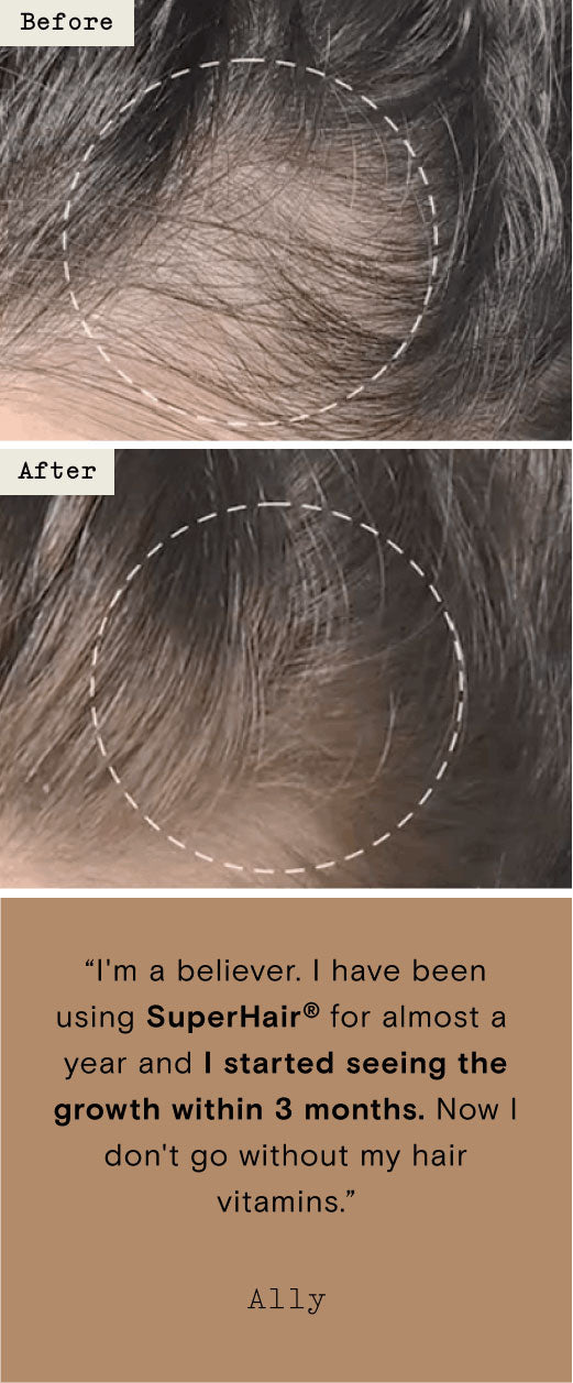 SuperHair quote