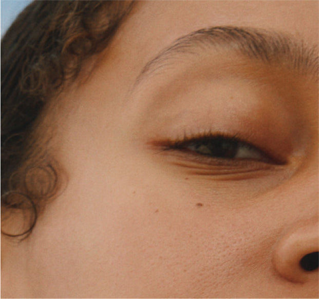 Over-Exfoliated Skin: How to Tell & What to Do