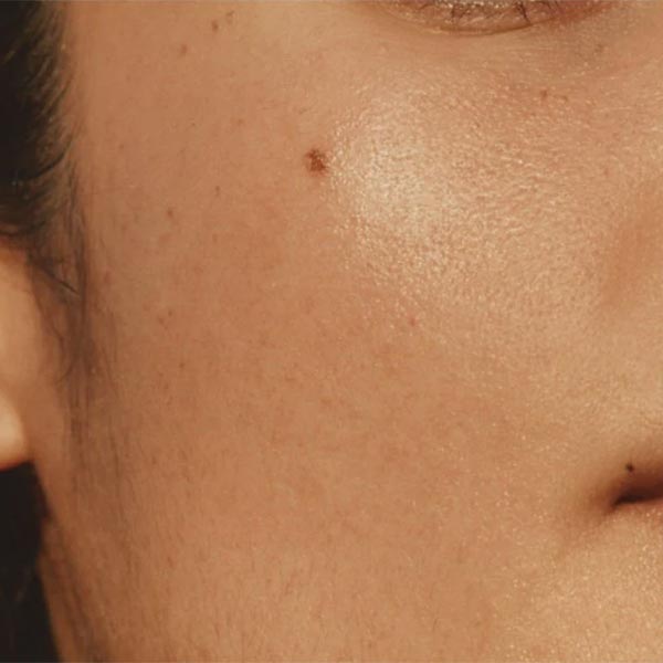 Everything You Need to Know About AHA Exfoliants