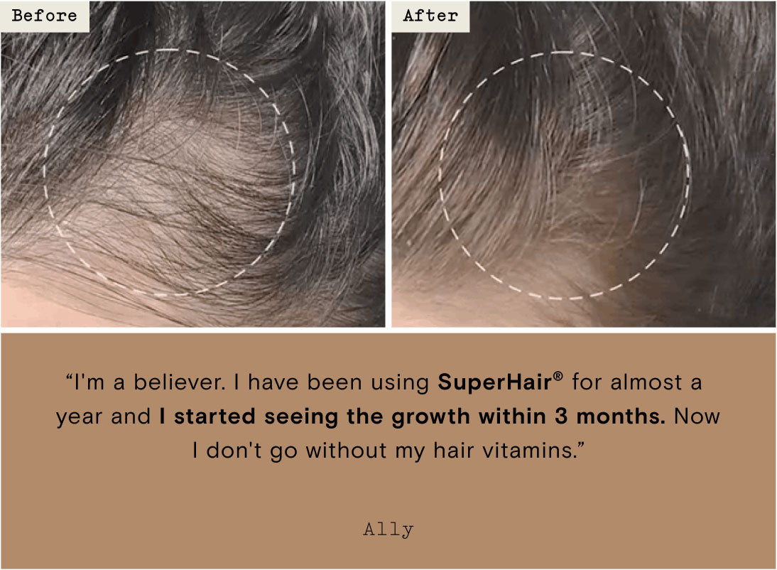 SuperHair quote