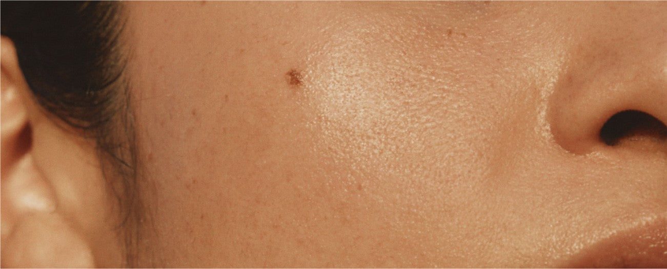 Everything You Need to Know About AHA Exfoliants