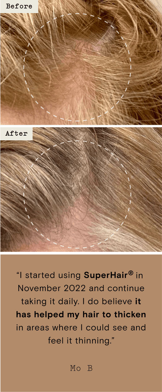 SuperHair quote
